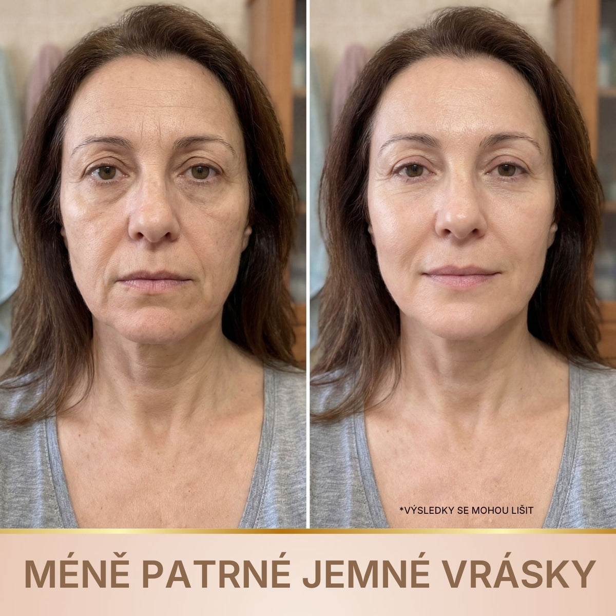 Elviorra – Korejské sérum s liftingovým efektem