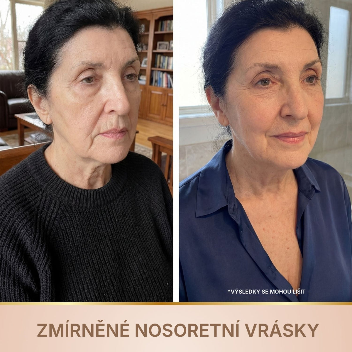Elviorra – Korejské sérum s liftingovým efektem