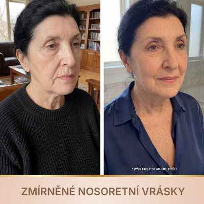 Elviorra – Korejské sérum s liftingovým efektem